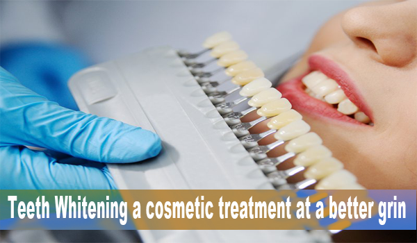 Teeth Whitening cosmetic treatment