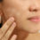 How To Get Rid Of White Spots On The Skin
