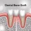 Dental Bone Graft: Procedure, Recovery, and Benefits