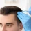 Regrow Your Hair Naturally with Stem Cell Hair Treatment