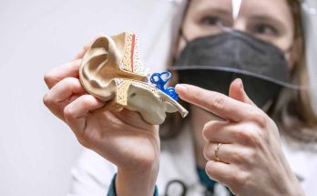 Understanding Tinnitus